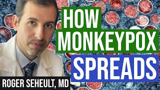Monkeypox (Mpox) Update 4: How it Spreads, Tecovirimat, and Jynneos