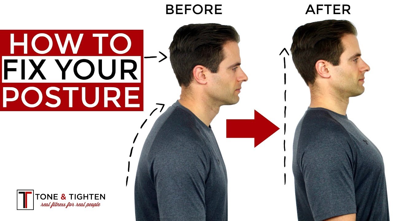 How To Correct Your Posture – 5 Home Exercises To Fix Your Posture ...