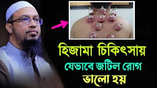 হিজামা চিকিৎসায় জটিল রোগ যেভাবে ভালো হয় | Sheikh Ahmadullah