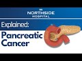 Pancreatic Cancer Explained| Risk factors and Symptoms of Pancreatic Cancer