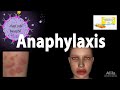 Anaphylaxis, Animation