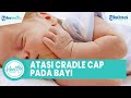 Apa itu Cradle Cap? Kenali Gejala dan Cara Penyembuhan pada Bayi