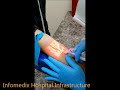 #how vein finder work