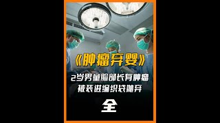 2岁男童因脸部有巨大肿瘤，竟被父母装进编织袋，抛弃到医院自生自灭 #纪录片  #遗弃