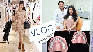 VLOG จัดฟันรอบ2 , ไป Event