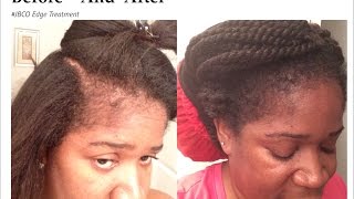 Jamaican Black Castor Oil EDGE TREATMENT| How To Safely ReGrow Your Edges| Hairline| BaldSpot