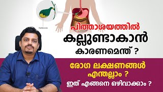 പിത്തസഞ്ചിയിലെ കല്ലുകൾ ഉണ്ടാവുന്നത് എങ്ങനെ ? ഇത് എങ്ങനെ ഒഴിവാക്കാം | pithashaya kallu maran