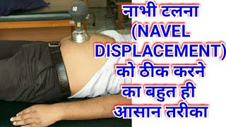 Navel Displacement Treatment/Navel Displacement Cure/Nabhi Talna/Navel Displacement