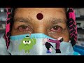 information about pink eye or red eye or madras eye infection epidemic english