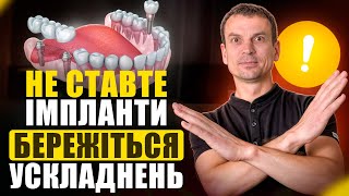 Кому НЕ МОЖНА ставити Імпланти? Стоматологи МОВЧАТЬ про це!