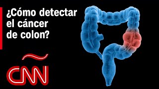 ¿Cómo detectar el cáncer de colon? El Dr. Huerta responde