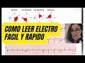 Leer ELECTROCARDIOGRAMA facil y RÁPIDO