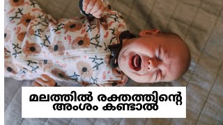 Blood in stools/ മലത്തിൽ രക്തം കണ്ടാൽ/Babycare tips Dr Bindu