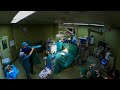 6 Hour Open Heart Surgery Timelapse