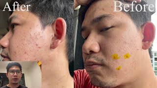 Skincare routine EP.02 เริ่มต้นใหม่อีกครั้งและวัดผล