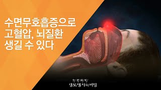 수면무호흡증으로 고혈압, 뇌질환 생길 수 있다 - (20140129_491회 방송)_당신의 밤은 안녕하십니까? 불면증