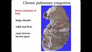 4.1 Practice - hemodynamic disorder