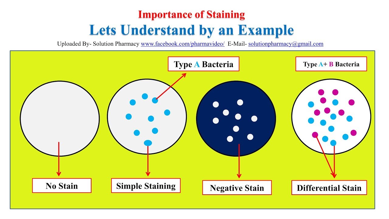 Microbial Staining= Simple Staining | Gram Staining | Acid Fast ...