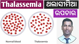 Thalassemia Home remedies | Treatment of Thalassemia | How to control Thalassemia | in odia |