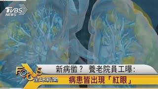 FOCUS／新病徵？ 養老院員工曝: 病患皆出現「紅眼」