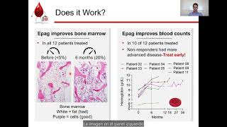 FA Connect: Eltrombopag Clinical Trial Update 2022