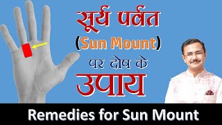 सूर्य पर्वत के दोष और उपाय  || Remedies for bad sign on Sun mount || Upay -9