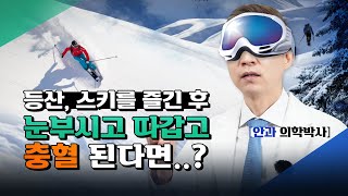 스키나 등산에서 선글라스를 껴야하는 이유! 설맹 눈화상 예방법.