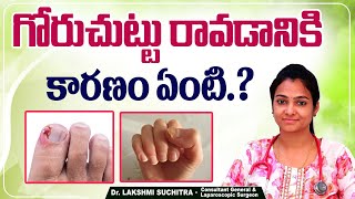 గోరు చుట్టు | Causes and Symptoms of Nail Infection | Paronychia | Goru Chuttu | Sankhya Hospitals