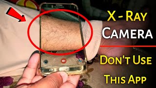 X Ray Camera Body Scanner App | Real or Fake