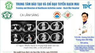 Vai trò của EBUS trong chẩn đoán tổn thương trung thất