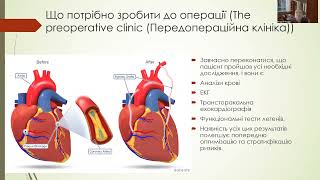 Анестезіологічне забезпечення хірургічного лікування набутих вад серця. Мазур А.П.