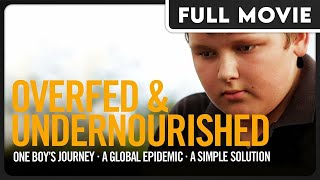 Overfed and Undernourished - Examining Obesity and Modern Lifestyles - Health & Wellness