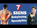 7 Signs of Ankylosing Spondylitis - A Rheumatologist Review