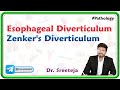 2. Esophageal Diverticulum / Zenker's diverticulum : USMLE Step 1 Pathology