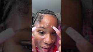 Should I pop these pimples?! 👀 #skincare #acneproneskin #pimple #skincareroutine #oddlysatisfying