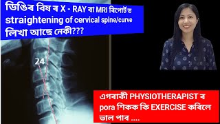 ডিঙিৰ বিষ, হাত ভৰিৰ জিনজিননী কাৰণ হব পাৰে  straightening of cervical curve| Cervical kyphosis | 2024