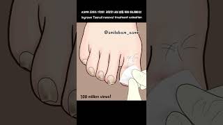 ASMR ASMR Ingrown Toenail removal #treatment #animation #trending #shorts #dentalcare