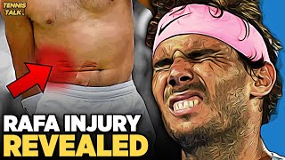 Nadal Injury Revealed at Australian Open 2023 | Tennis Talk News