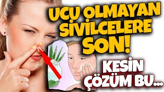 Deri Altında, Ucu Olmayan Kör Sivilce Nasıl Geçer?