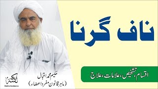 Belly Button ● ناف کے مسائل اور ان کا علاج ● नाभि ● Nukta Guidance