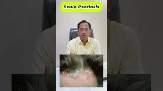 केसांमध्ये कोंडा की सोरायसिस कसे ओळखावे? scalp Psoriasis #shorts by Dr. Rupesh Amale