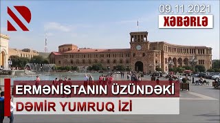 Ermənistanın üzündəki Dəmir yumruq izi - Paşinyan \