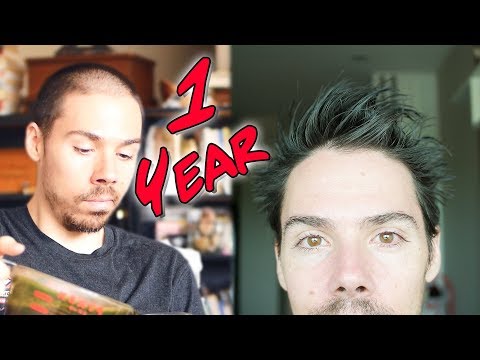 1 Year Male Pattern Baldness Reversal: How I Did It 1 Year Male Pattern Baldness Reversal: How I Did It