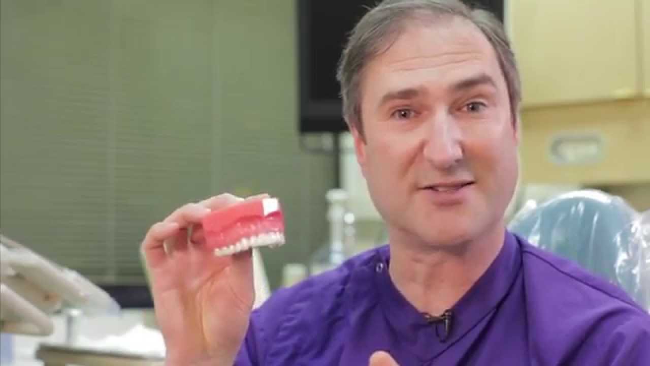 Invisalign Youtube