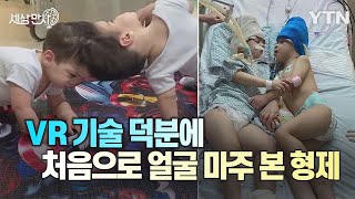 [세상만사] 가상현실(VR) 이용해 이마 붙은 샴쌍둥이 분리 수술 성공 / YTN