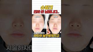 슈링크 유니버스 이것만은 알고 받기!⭐