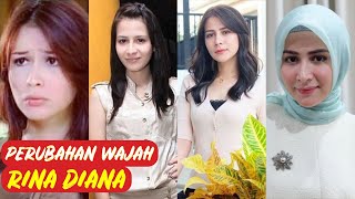 TERUNGKAP! Perubahan Wajah Rina Diana! Rina Diana Siapa ?! Biodata Rina Diana Lengkap