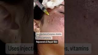 Mesotherapy for Skin Repair