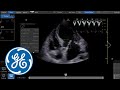 Venue Ultrasound Tutorial: Shock Tool Kit | GE Healthcare