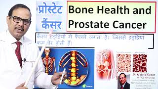 Prostate Cancer and Bone Health. | Dr.(Prof)Santosh Kumar PGI.